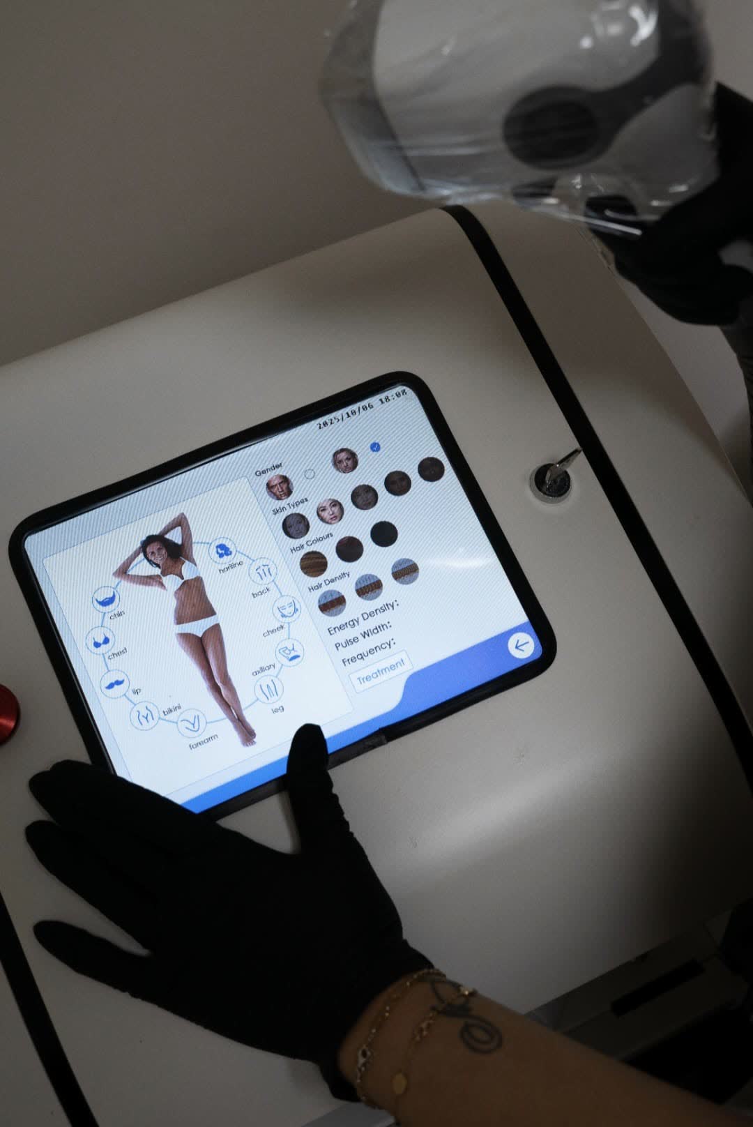 Epilazione Laser — Tecnologia Avanzata