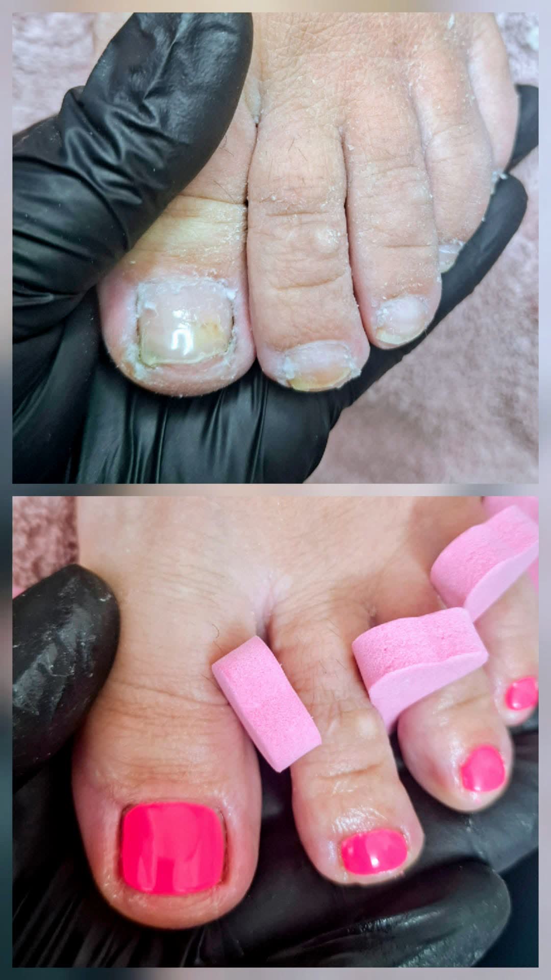 Pedicure — Prima e Dopo