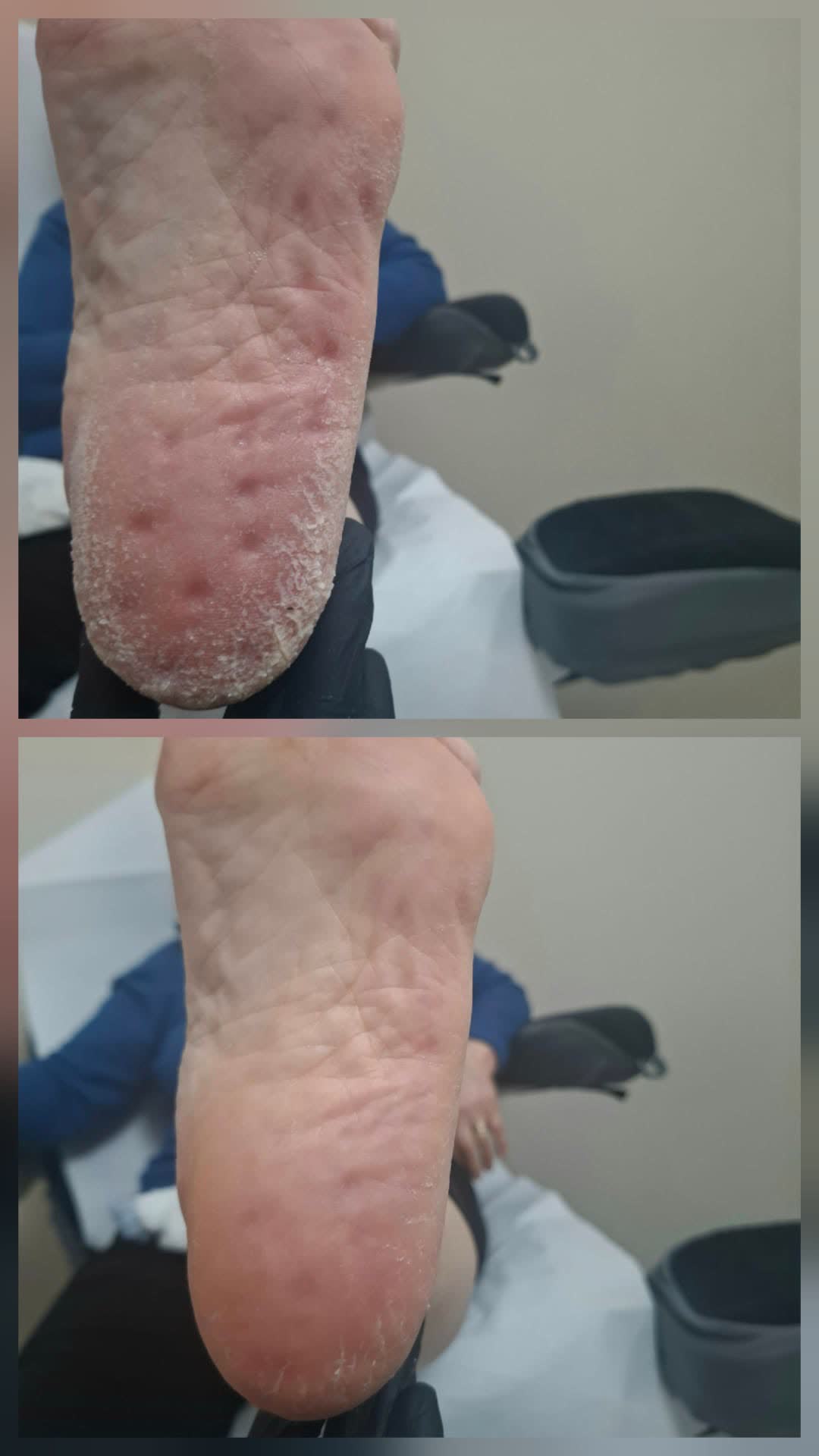Pedicure — Prima e Dopo